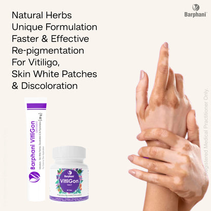 बर्फानी विटलीगोन डुओ-विटिलिगो क्रीम (2) विटलीगोन टैब (60)विटिलिगो सफेद पैच, मलिनकिरण और पुन: रंजकता पर प्रभावी
