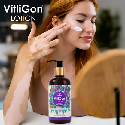 Barphani VitliGon Lotion 200ml for Vitiligo White Patches Uneven Skin Tone & Pigmentation Ayurvedic Solution Helps Restrict Spread & Increase Melanin