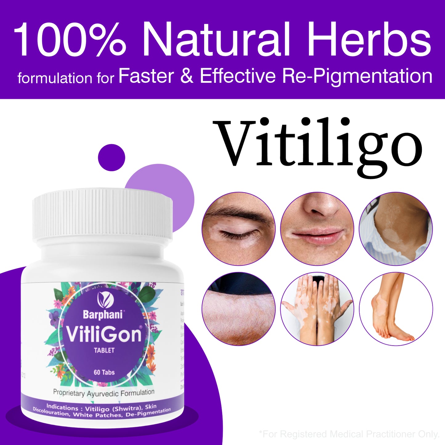 बर्फानी विटलीगोन टैबलेट - सफेद पैच, रंग बदलने, डी-पिगमेंटेशन, तेज़ परिणामों पर अत्यधिक प्रभावी, स्प्रेड को प्रतिबंधित करने में मदद करता है- 60 टैब पैक