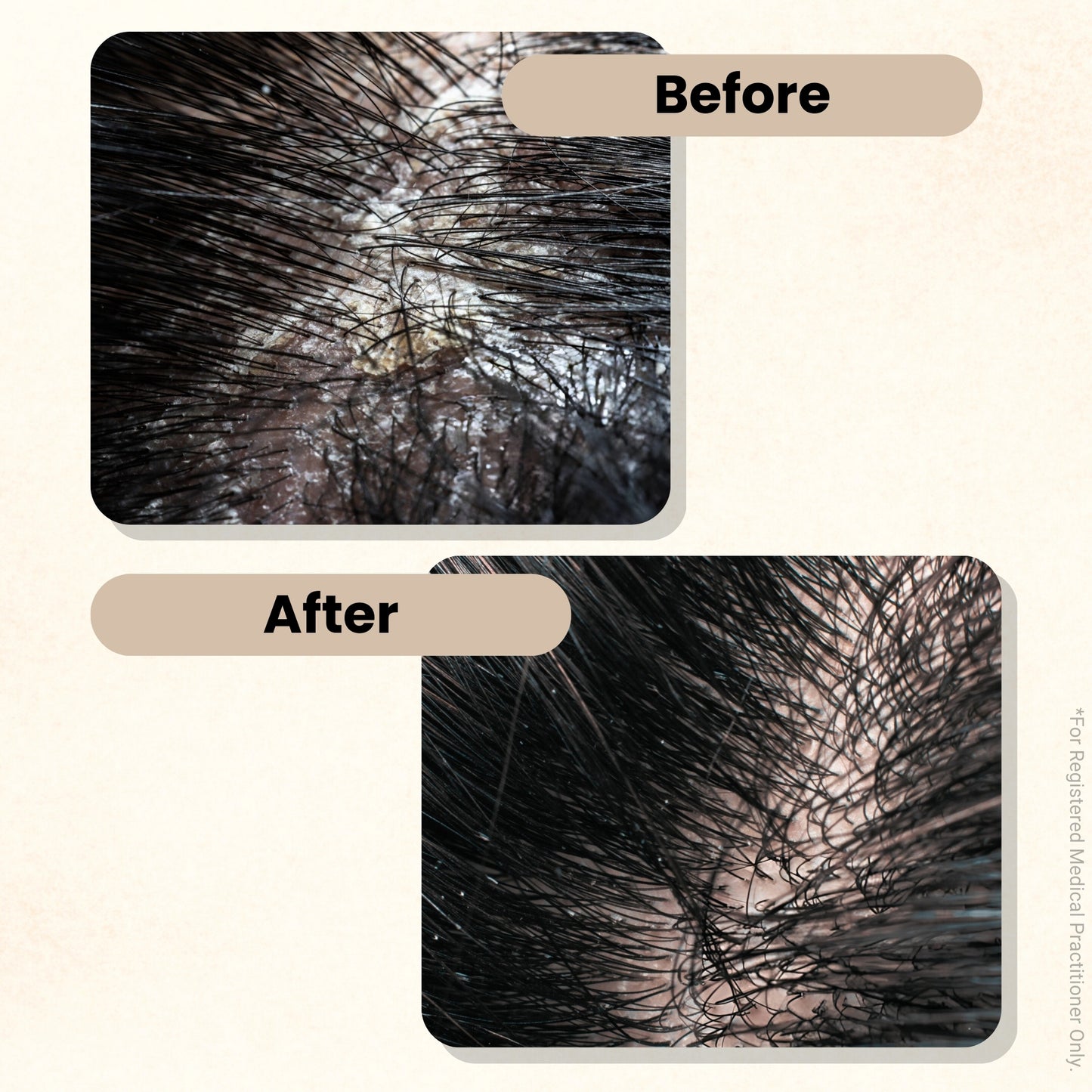 ScalpMate Herbal Anti Dandruff Shampoo