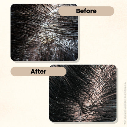 ScalpMate Herbal Anti Dandruff Shampoo