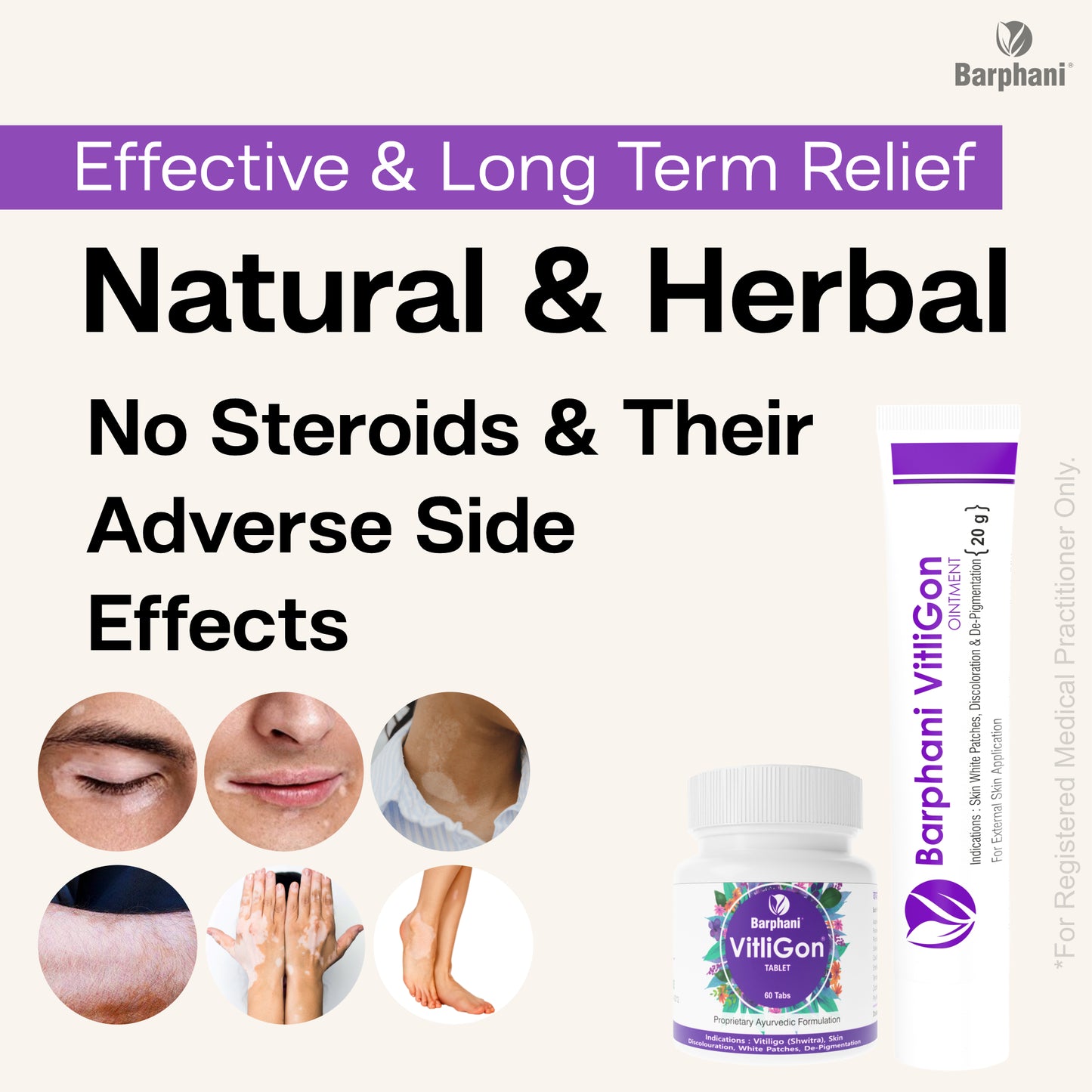 बर्फानी विटलीगोन डुओ-विटिलिगो क्रीम (2) विटलीगोन टैब (60)विटिलिगो सफेद पैच, मलिनकिरण और पुन: रंजकता पर प्रभावी