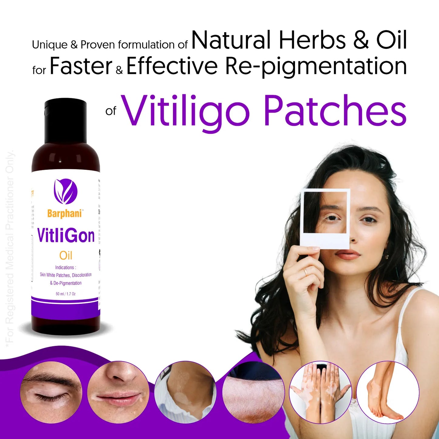 Barphani VitliGon Oil 200ml - Super Effective on Vitiligo White Patches, Discolouration, De-Pigmentation, Faster Results, Helps Restricts Spread