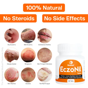 বারফানি EczoNil ট্যাব(৬০)-দ্রুত উপশম ক্রনিক একজিমা ডার্মাটাইটিস সোরিয়াসিস এক্সফোলিয়েটিভ চেইলাইটিস (ইসি) দাদ ছত্রাক সংক্রমণ চুলকানি লালভাব শুষ্ক ত্বক